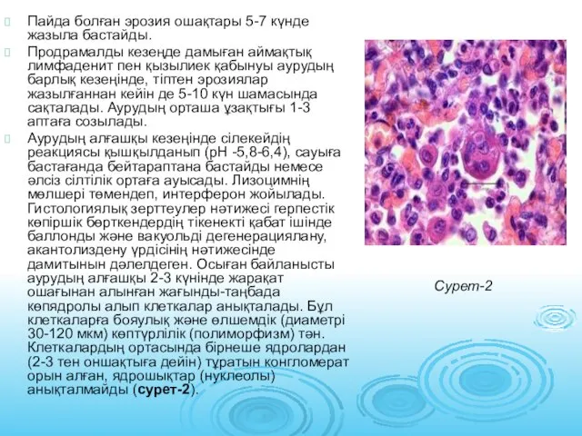 Пайда болған эрозия ошақтары 5-7 күнде жазыла бастайды. Продрамалды кезеңде дамыған аймақтық