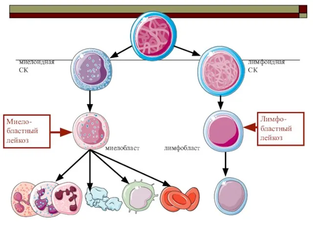 миелобласт лимфобласт миелоидная СК лимфоидная СК Миело- бластный лейкоз Лимфо- бластный лейкоз