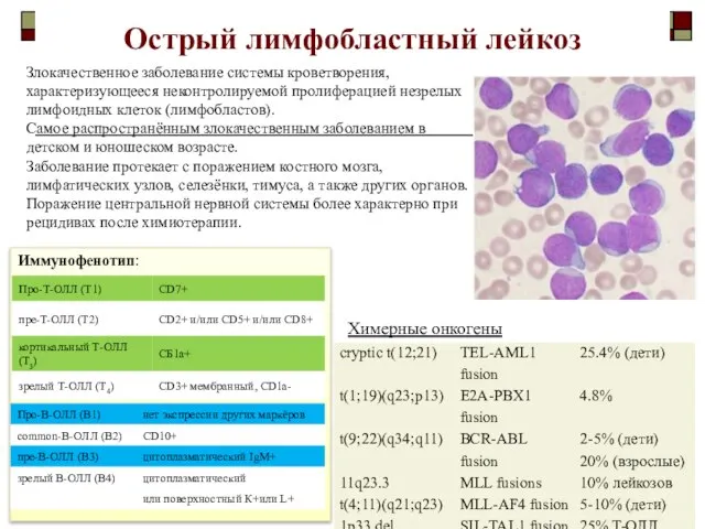 Острый лимфобластный лейкоз Злокачественное заболевание системы кроветворения, характеризующееся неконтролируемой пролиферацией незрелых лимфоидных