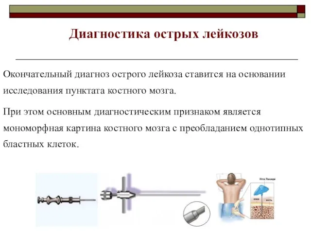 Окончательный диагноз острого лейкоза ставится на основании исследования пунктата костного мозга. При