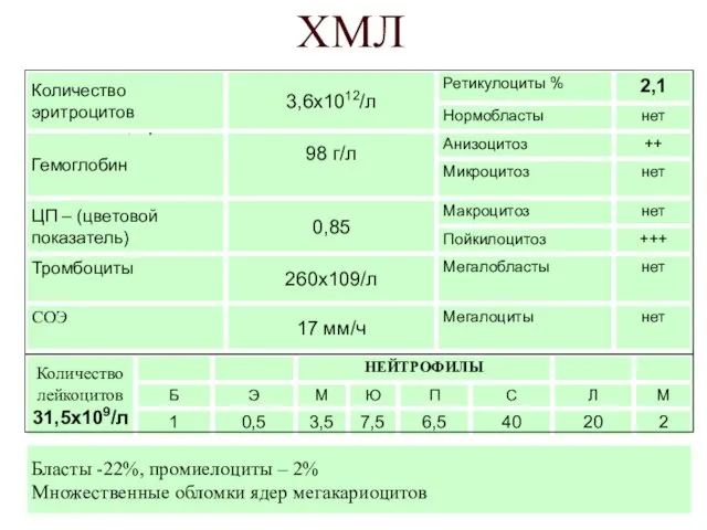 ХМЛ Бласты -22%, промиелоциты – 2% Множественные обломки ядер мегакариоцитов