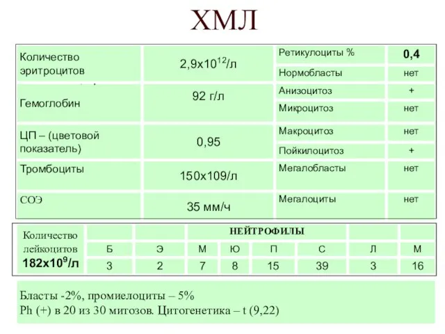 ХМЛ Бласты -2%, промиелоциты – 5% Ph (+) в 20 из 30