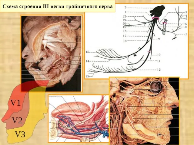 Схема строения III ветви тройничного нерва