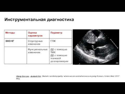 Инструментальная диагностика Wang-Soo Lee, Jaetaek Kim, Diabetic cardiomyopathy: where we are and