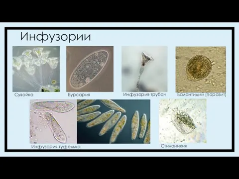 Инфузории Инфузория-туфелька Балантидий (паразит) Сувойка Инфузория-трубач Бурсария Стилонихия