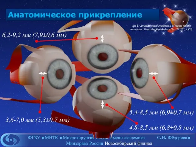 Анатомическое прикрепление 3,6-7,0 мм (5,3±0,7 мм) 5,4-8,5 мм (6,9±0,7 мм) 4,8-8,5 мм