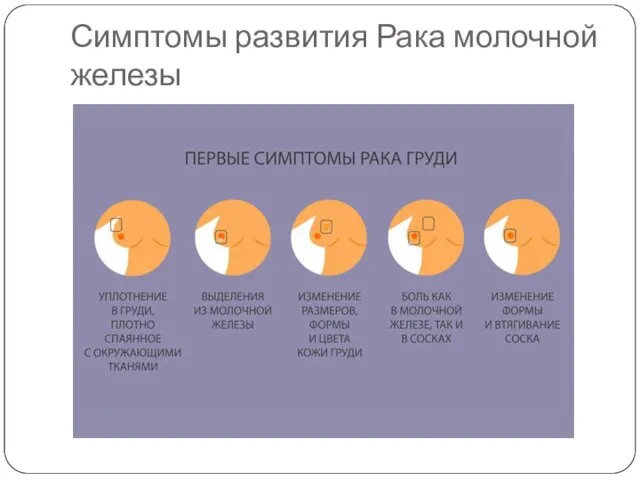 Симптомы развития Рака молочной железы