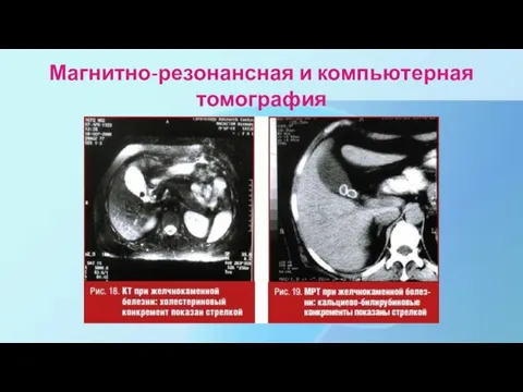 Магнитно-резонансная и компьютерная томография