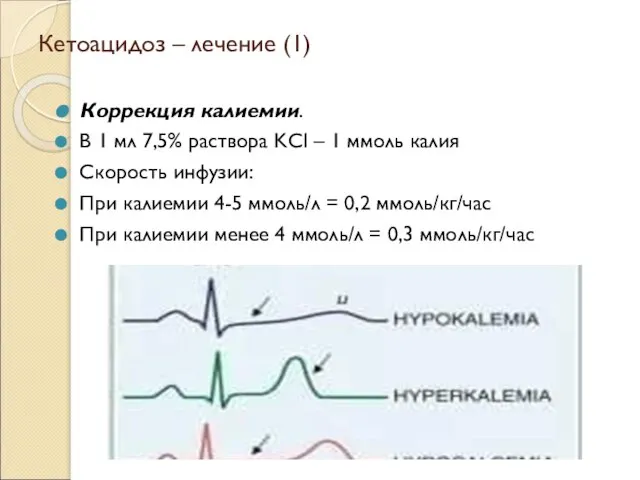 Кетоацидоз – лечение (1) Коррекция калиемии. В 1 мл 7,5% раствора KCl