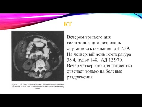 КТ Вечером третьего дня госпитализации появилась спутанность сознания, pH 7.39. На четвертый