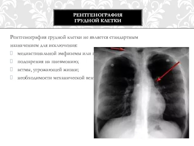 Рентгенография грудной клетки не является стандартным назначением для исключения: медиастинальной эмфиземы или