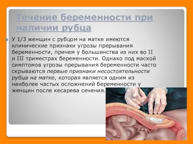 Течение беременности при наличии рубца У 1/3 женщин с рубцом на матке