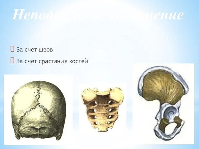 Неподвижное соединение За счет швов За счет срастания костей