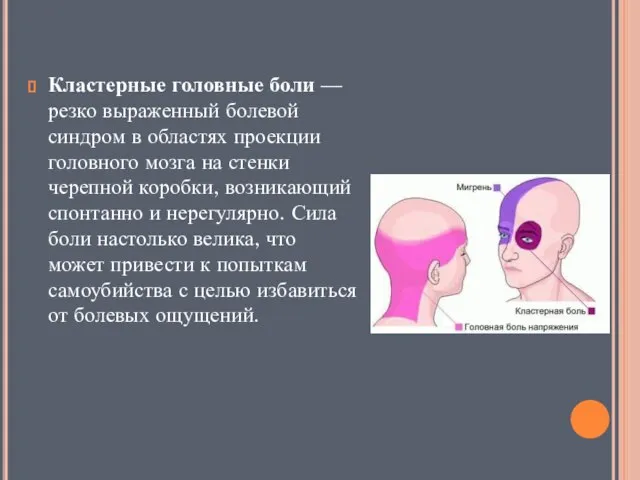 Кластерные головные боли — резко выраженный болевой синдром в областях проекции головного