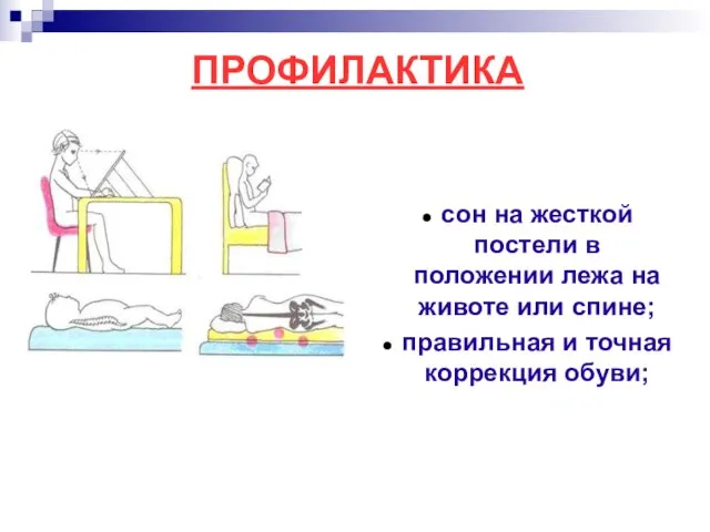 сон на жесткой постели в положении лежа на животе или спине; правильная