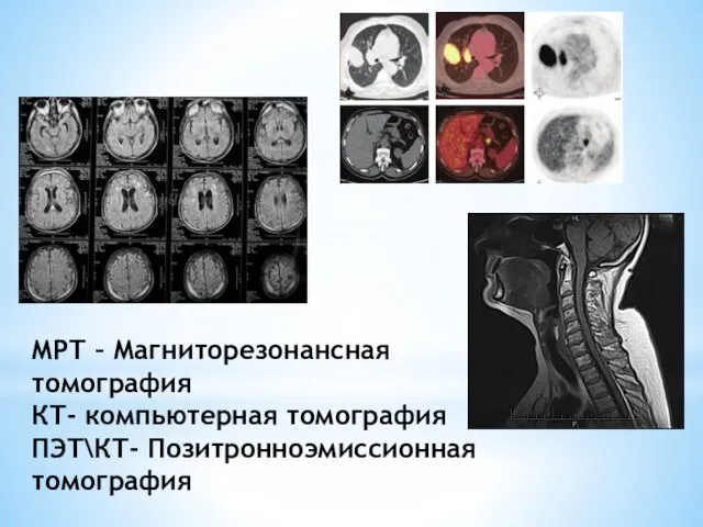 МРТ – Магниторезонансная томография КТ- компьютерная томография ПЭТ\КТ- Позитронноэмиссионная томография