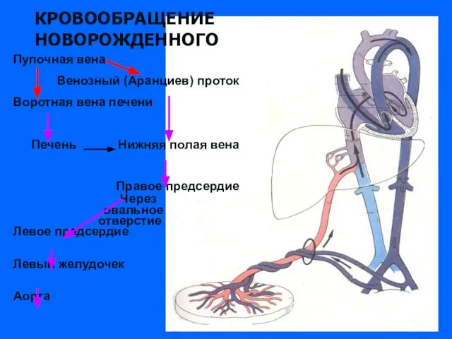 КРОВООБРАЩЕНИЕ НОВОРОЖДЕННОГО