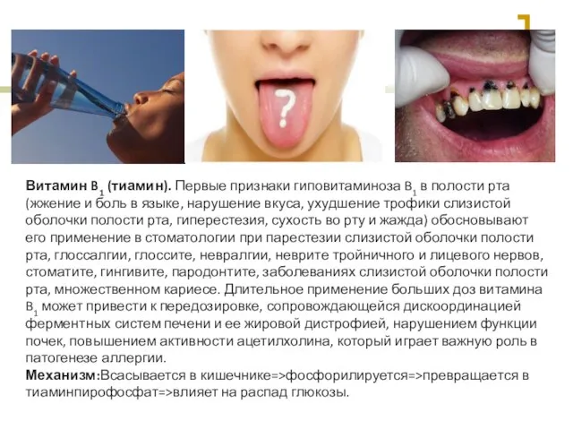 Витамин B1 (тиамин). Первые признаки гиповитаминоза B1 в полости рта (жжение и