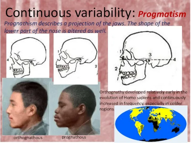 Continuous variability: Progmatism Prognathism describes a projection of the jaws. The shape