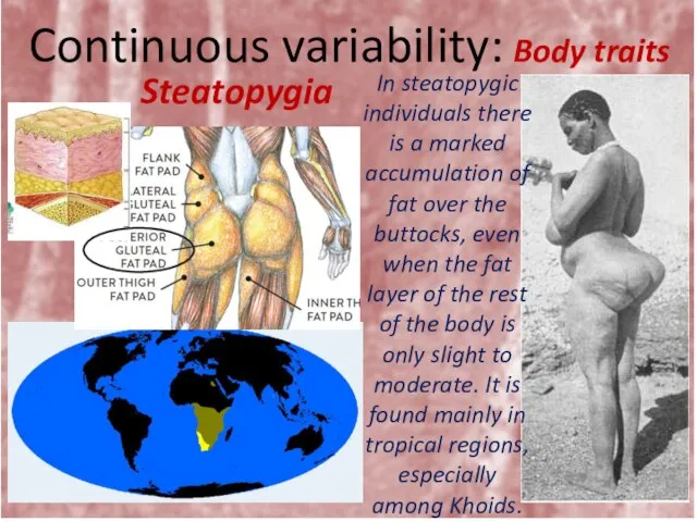 Continuous variability: Body traits Steatopygia In steatopygic individuals there is a marked