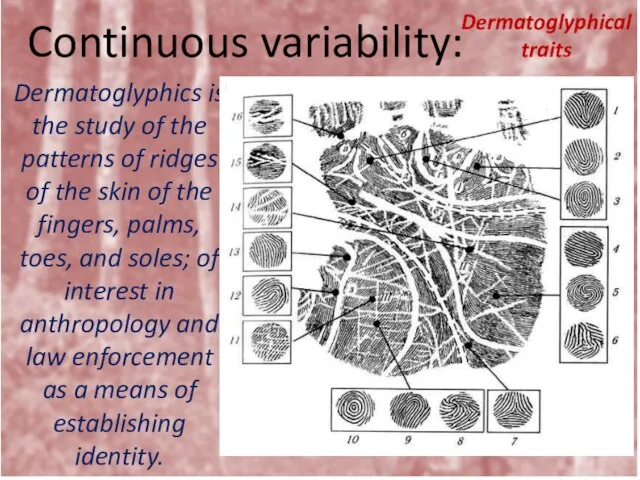 Continuous variability: Dermatoglyphical traits Dermatoglyphics is the study of the patterns of