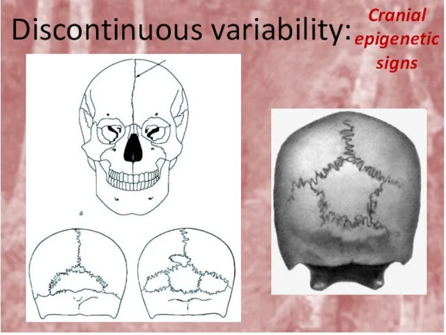 Discontinuous variability: Cranial epigenetic signs