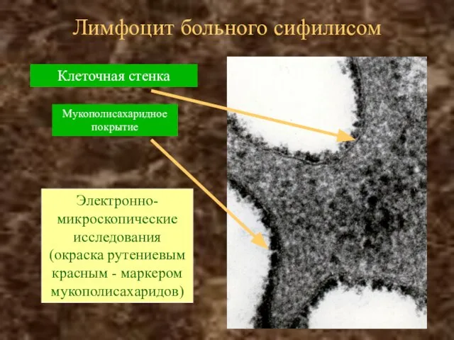 Лимфоцит больного сифилисом Электронно-микроскопические исследования (окраска рутениевым красным - маркером мукополисахаридов) Клеточная стенка Мукополисахаридное покрытие
