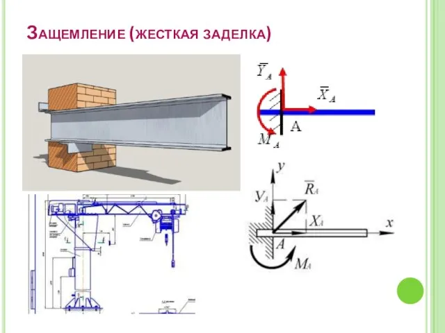 Защемление (жесткая заделка)