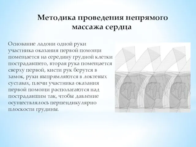 Методика проведения непрямого массажа сердца Основание ладони одной руки участника оказания первой