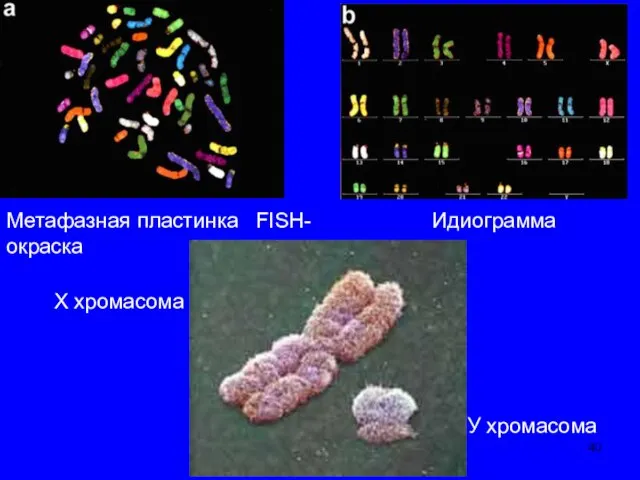 Метафазная пластинка FISH-окраска Идиограмма У хромасома Х хромасома