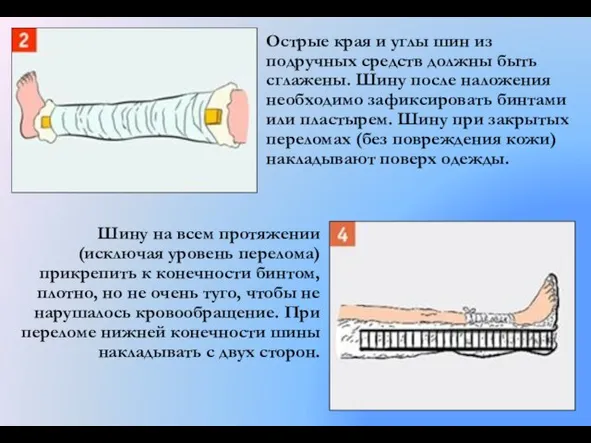 Острые края и углы шин из подручных средств должны быть сглажены. Шину