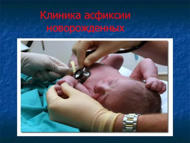 Клиника асфиксии новорожденных