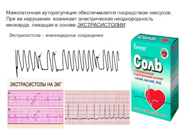 Межклеточная ауторегуляция обеспечивается посредством нексусов. При ее нарушении возникает электрическая неоднородность миокарда,