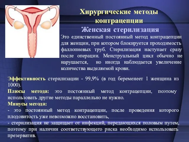 Хирургические методы контрацепции Женская стерилизация Эффективность стерилизации - 99,9% (в год беременеет