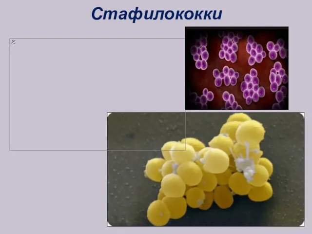 Стафилококки