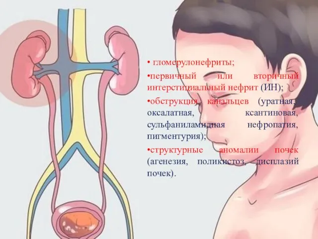 • гломерулонефриты; •первичный или вторичный интерстициальный нефрит (ИН); •обструкция канальцев (уратная, оксалатная,