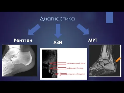 Диагностика Рентген УЗИ МРТ