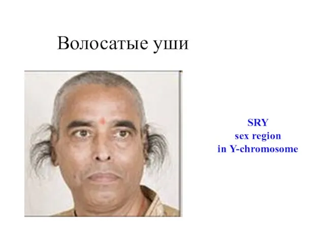 Волосатые уши SRY sex region in Y-chromosome