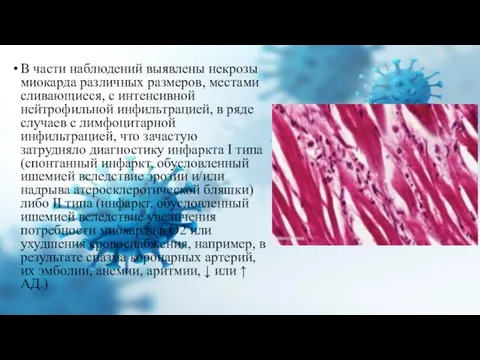 В части наблюдений выявлены некрозы миокарда различных размеров, местами сливающиеся, с интенсивной