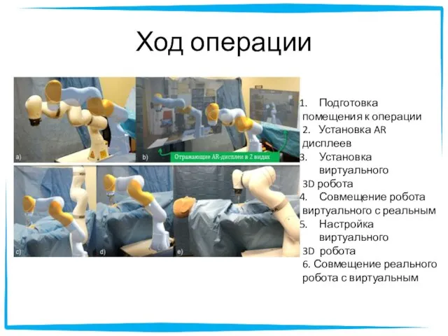 Ход операции Подготовка помещения к операции 2. Установка AR дисплеев Установка виртуального
