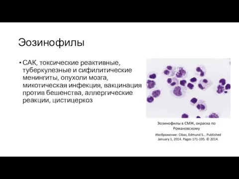 Эозинофилы САК, токсические реактивные, туберкулезные и сифилитические менингиты, опухоли мозга, микотическая инфекция,