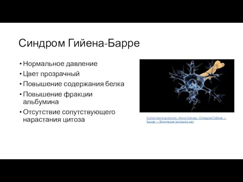 Синдром Гийена-Барре Нормальное давление Цвет прозрачный Повышение содержания белка Повышение фракции альбумина