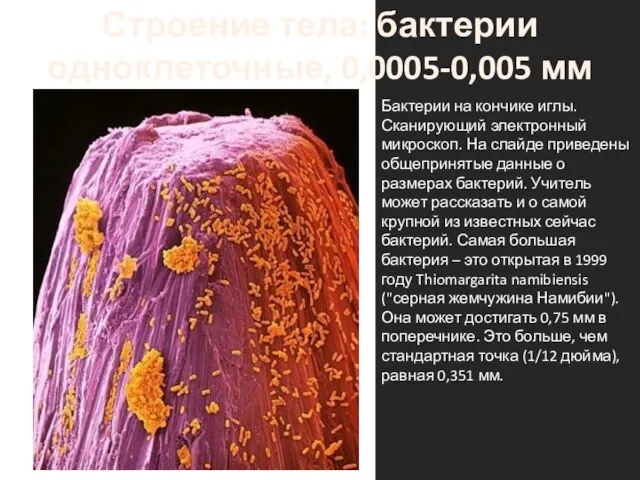 Бактерии на кончике иглы. Сканирующий электронный микроскоп. На слайде приведены общепринятые данные