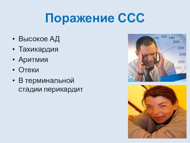 Поражение ССС Высокое АД Тахикардия Аритмия Отеки В терминальной стадии перикардит