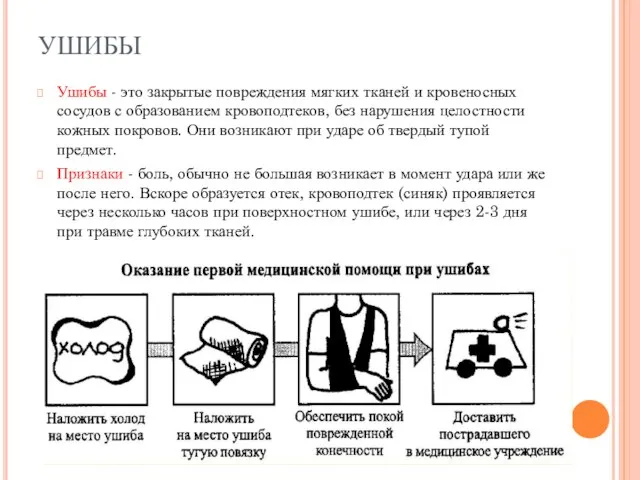 УШИБЫ Ушибы - это закрытые повреждения мягких тканей и кровеносных сосудов с