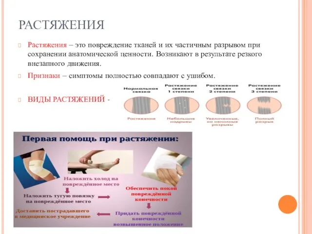 РАСТЯЖЕНИЯ Растяжения – это повреждение тканей и их частичным разрывом при сохранении