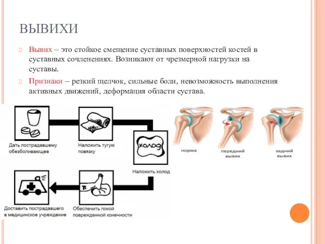 ВЫВИХИ Вывих – это стойкое смещение суставных поверхностей костей в суставных сочленениях.