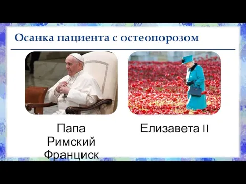 Осанка пациента с остеопорозом