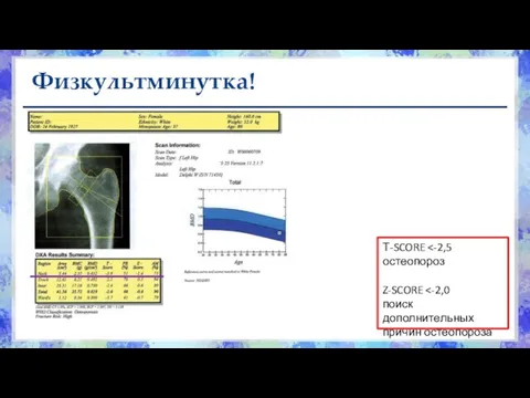 Физкультминутка! Т-SCORE Z-SCORE