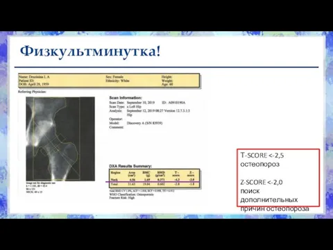 Физкультминутка! Т-SCORE Z-SCORE